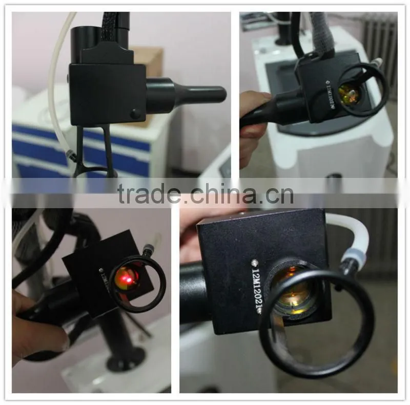 fractional co2 laser acne scar removal