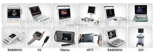 C7 KONTED 3D Portable Color Doppler Ultrasound Machine