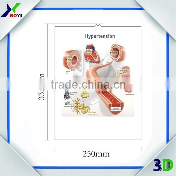 New Designs 3D PVC embossed medical poster