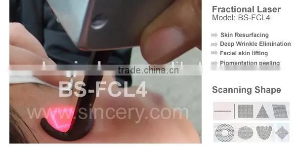 Fractional co2 laser skin resurfacing and stretch mark removal machine