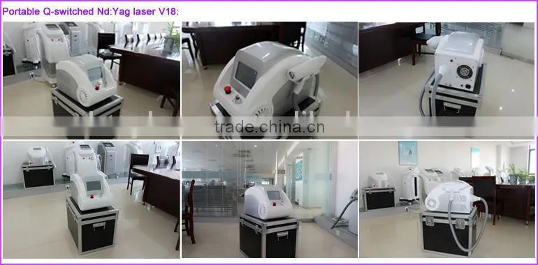 Q switched Nd Yag carbon Laser for skin rejuvenation