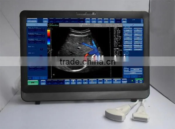 Touch Screen Color Doppler Ultrasound Scanner C8 model