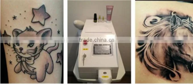 SQ-3 Q Best selling products portable nd yag remove tattoo laser/ home laser skin tightening/ at home skin tightening machine