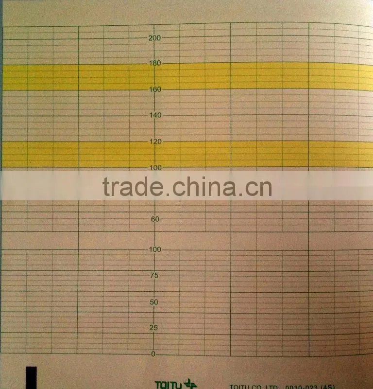 Fetal Monitor Paper / 152mm*150mm-150p Fetal Monitor Recording Paper for Toitu