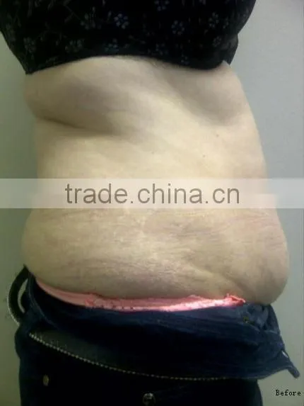 Ultra Cavi Lipo Machine-F019