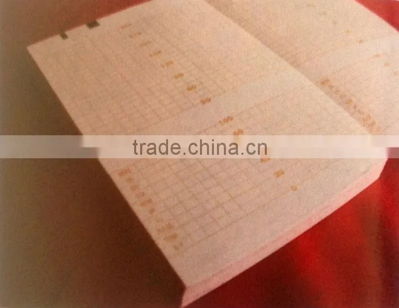 Fetal Monitor Paper / 150mm*100mm-150p Fetal Monitor Recording Paper
