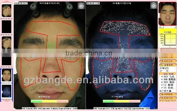 3D Comprehensive Analysis Magic Mirror Skin Analyzer Beauty Machine BD-P021