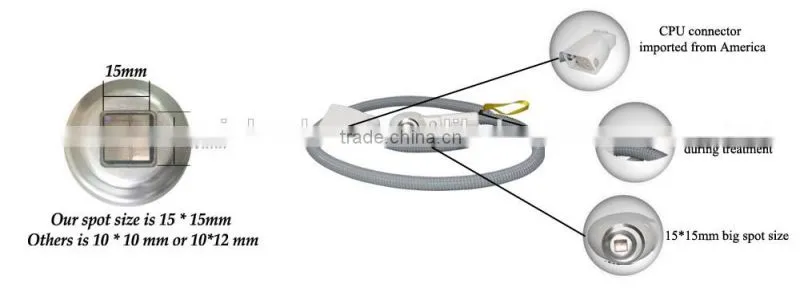 hair removal laser machines / laser hair removal eyebrows / laser hair removal turkey