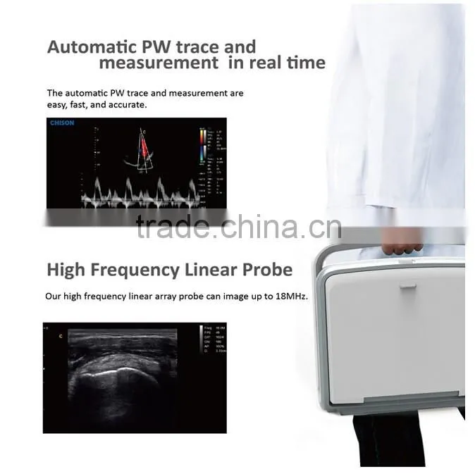 Laptop Color Doppler Ultrasound Price & portable color doppler ultrasound machine