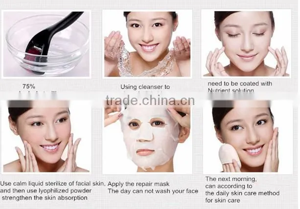 CE quality 4 in 1 derma roller stainless steel titanium derma roller for beauty skin care