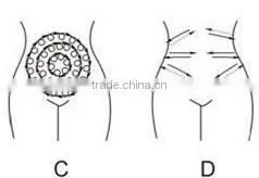 ultrasonic cavitation machine cavitation tripolar rf machine