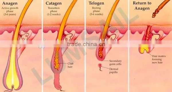 shr opt ipl diode laser permanent hair removal wholesale laser hair removal