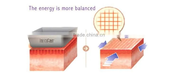 Portable Skin Tightening microwave frequency