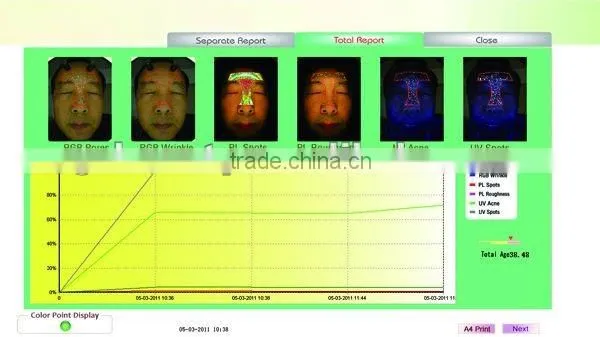 WT-03-S Super Trispectrum Magic mirror skin scanner analyzer