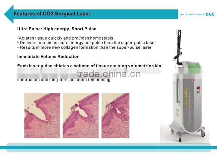 Good effect CO2 fractional laser skin spot removal wrinkle removal vaginal care machine--CV-I