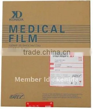 agfa digital film,medical x-ray image intensifier,t4 diagnostic