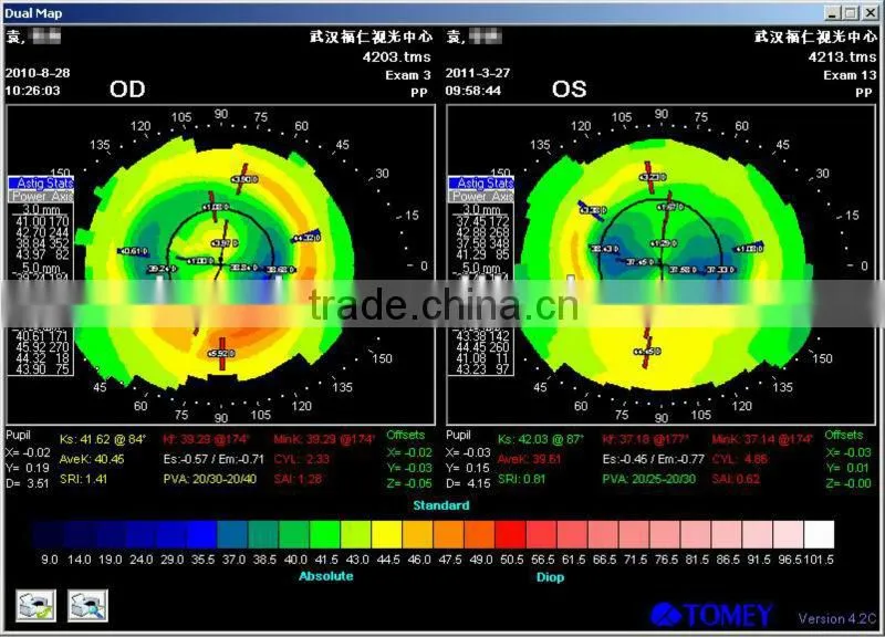 High-technology Mild MCT ,fpr myopia and amblyopia China