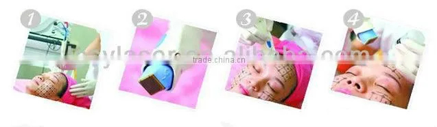 Best rf skin tightening face lifting machine&newest skin lifting machine
