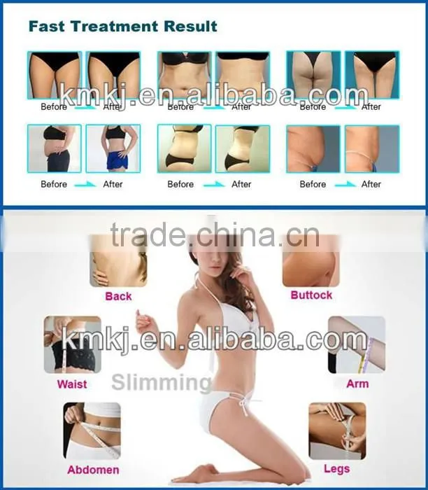 Hot selling 5 in 1 body fat analysis machine with vacuum cavitation system