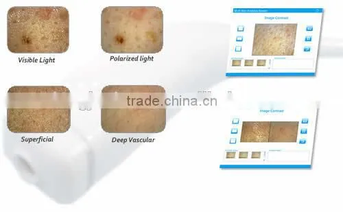 2014 hot sale salon furniture portable skin analyzer/ facial skin analyzer