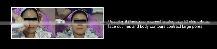 RL-F02 ipl machine/RF/laser 3 in 1 Multifunction beauty machine in Guangzhou Renlang Factory