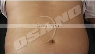 Cryo Slim Cryotherapy Cryolipolysis Beauty Slimming Machine