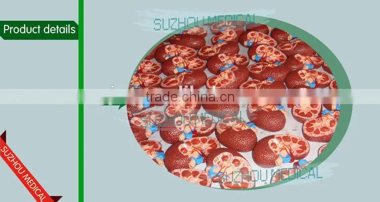 Effects of hypertension, 5 parts