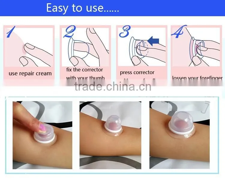 Imported High Medical Grade Silicone Nipple Correction Cups Breast Enlarger Nipple Corrector for Inverted or Flat Nipples