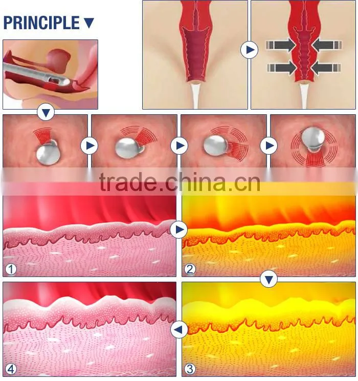 40w co2 laser fractional equipment Medical CE ISO13485
