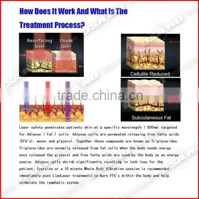 2016 Portable lipo laser machine with factory price