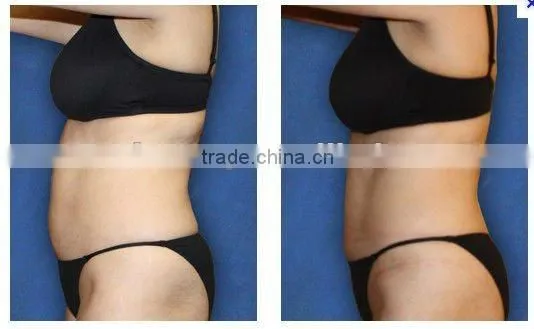 health & beauty weight loss slimming equipment -F017