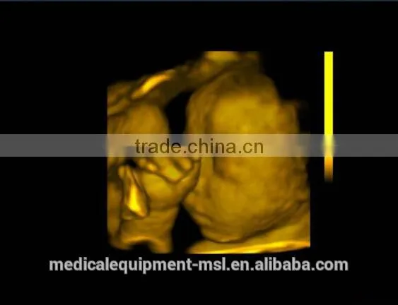 ultrasound machine ,ultrasound machine price,ultrasound scanner