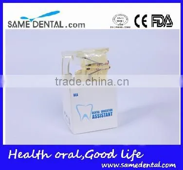 High Quality Dental Transparent Orthodontic Models School Teaching Demonstration