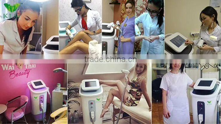 E808+ laser alma hair epilation machine/ 808nm diode laser / laser depilazione