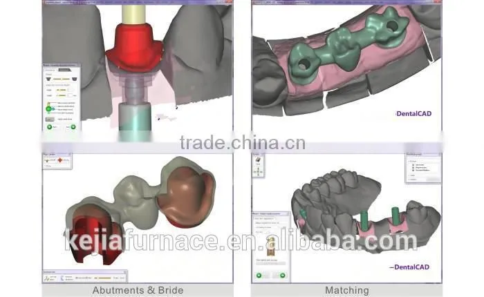 Dental scanner/manufacturer of dental materials
