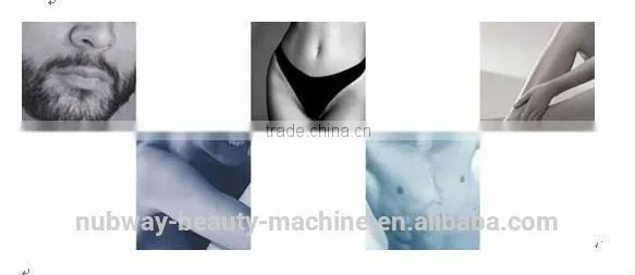 Upper Lip Hair Removal Machine 808nm Diode Laser