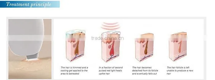 Portable home use diode laser hair removal