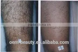 Factory direct sales !! 808nm Diode Laser+IPL diode laser hair removal with CE approved