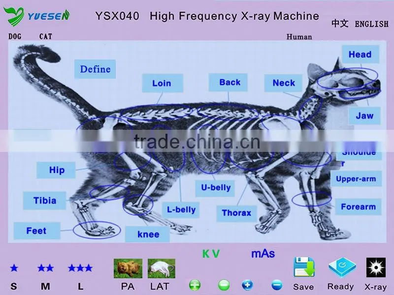 Medical X-ray scanner portable xray machine