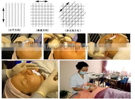 Interchangeable vibration DERMA ROLLER FOTON LED