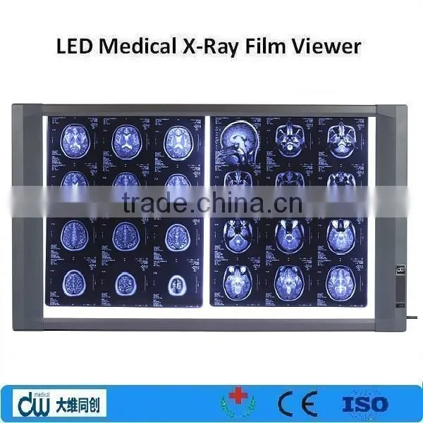 Ultra slim medical x-ray film viewer equipment/negatoscope