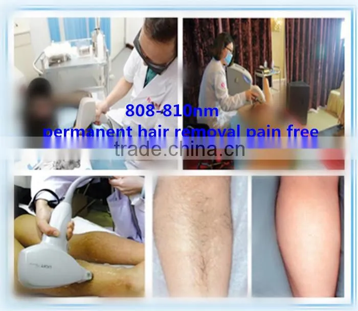 latest technology diode laser hair removal machine