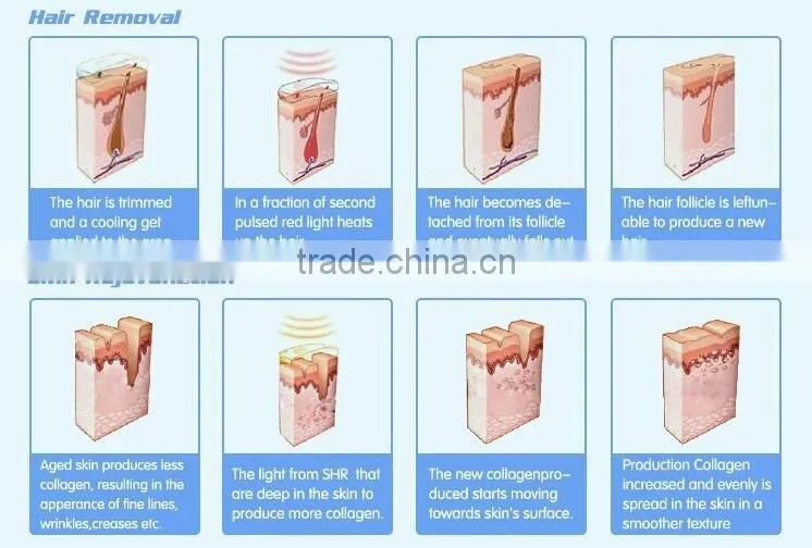2016 Chinese ipl shr hair removal machine from Beijing multifuncion for big promotion