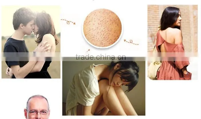 Brand high quality Mendior alpha hydroxy acid Skin Smoother moisturizing Remove Gallinaceous skin Body Lotion OEM custom brand