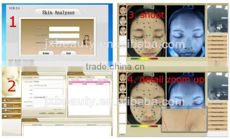 Portable skin analyzer skin scanner
