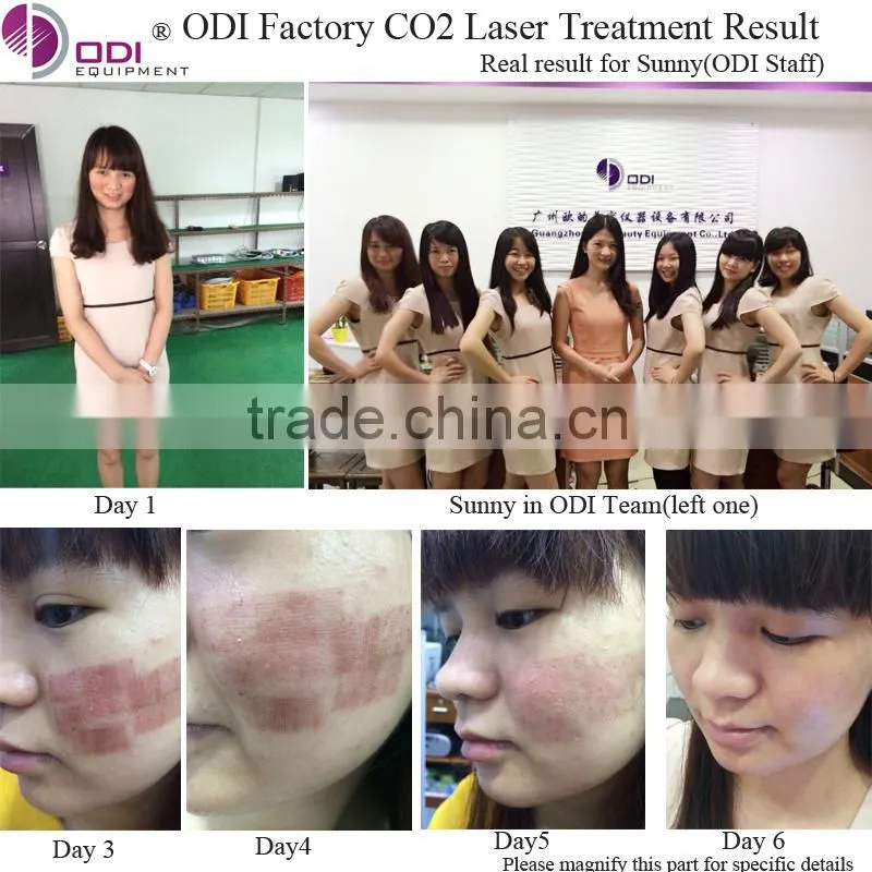 C600 Factory price!! 2015 Factory price beauty equipment pigment removal rf co2 fractional laser