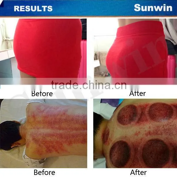 hot breast sucking and massage breast enlargement breast massager machine SW-68B