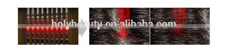 Portable Laser Diode Hair Loss Cure Therapy For Hair Growth Preventing Hair Loss