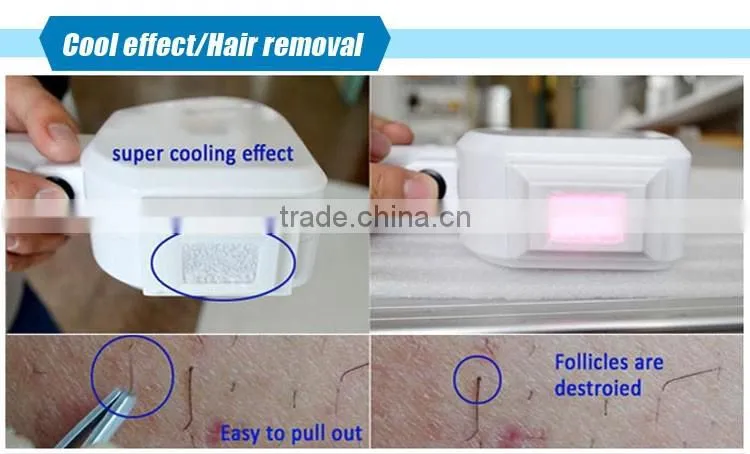 2016 New portable cold laser therapy device for 808nm diode laser(CE)