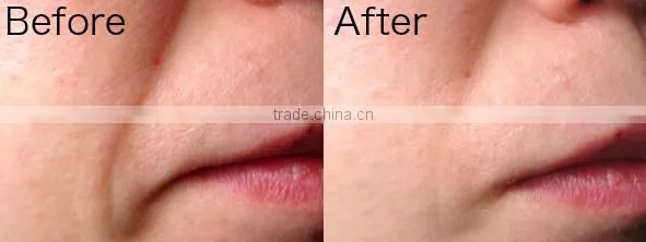 Japanese high quality anti aging face serum for sale